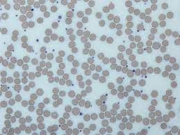 platelets