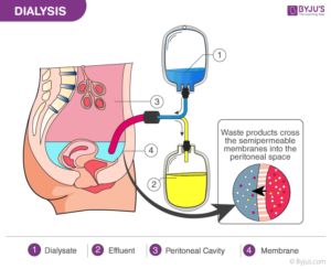 Excretion in Human