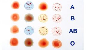 Blood group: